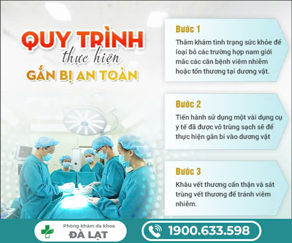 Hình ảnh minh họa